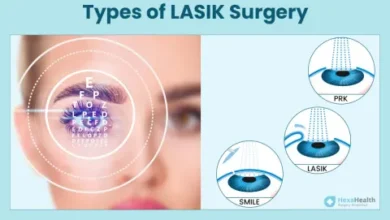 how much is laser eye surgery