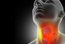 Can allergies cause sore throat