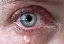 How to get something out of your eye