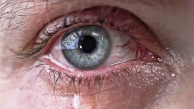 How to get something out of your eye
