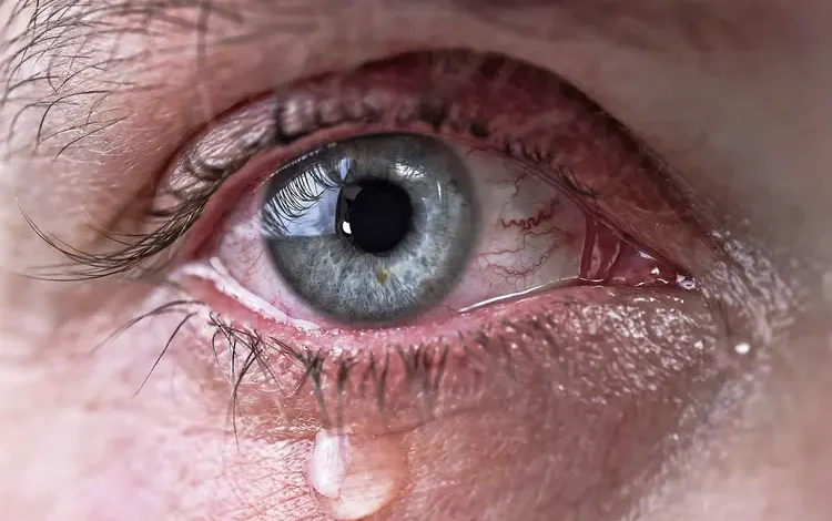How to get something out of your eye