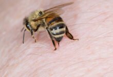 What Does a Bee Sting Look Like
