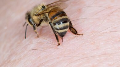 What Does a Bee Sting Look Like