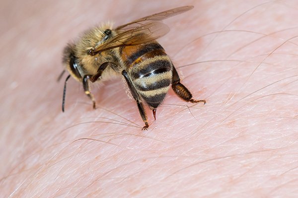 What Does a Bee Sting Look Like