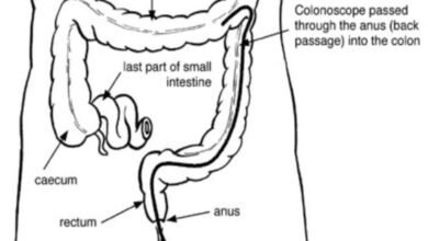 How long will i be on the toilet for colonoscopy prep